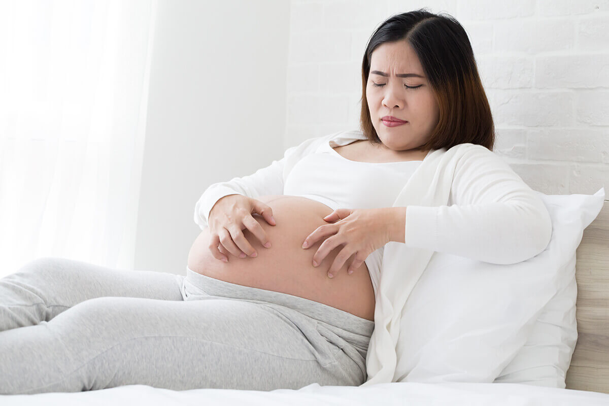Xử lý dị ứng da khi mang thai giúp mẹ bầu hết ngứa nhanh chóng