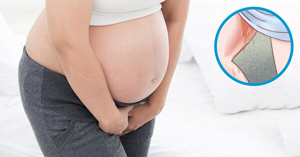 Vỡ ối là dấu hiệu dễ dàng nhận biết nhất